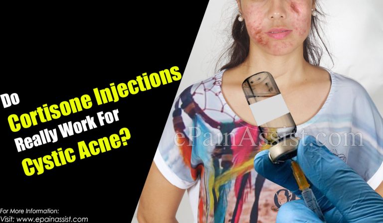 Benefits and Side Effects Of Using Cortisone Shots For Acne