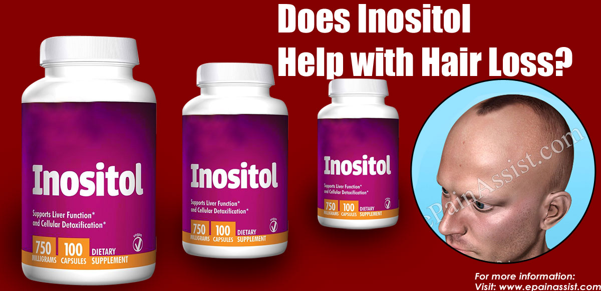 Does Inositol Help with Hair Loss?