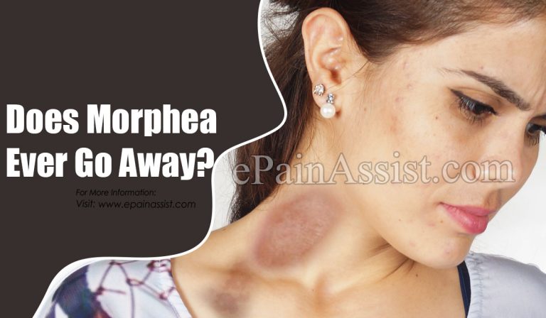 Does Morphea Ever Go Away?