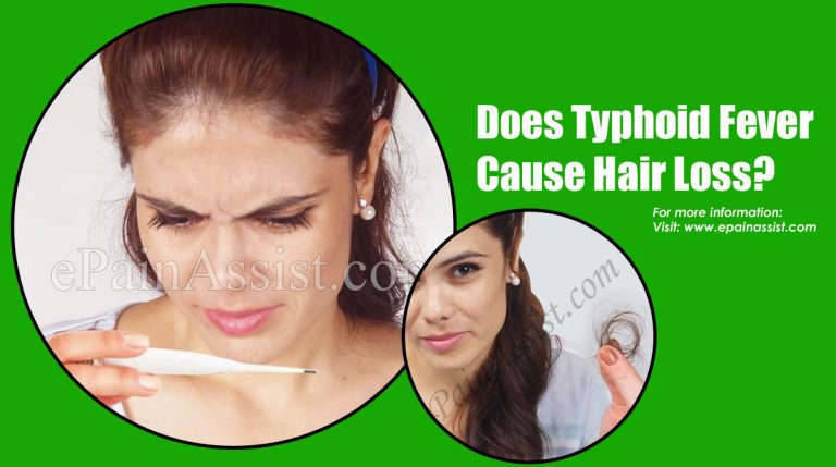Does Typhoid Fever Cause Hair Loss?| Home Remedies for Hair Loss Due to Typhoid