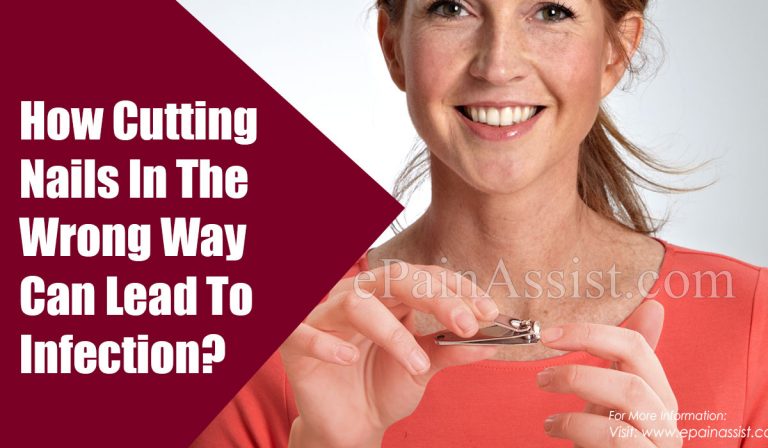 How Cutting Nails In A Wrong Way Lead To Infection?