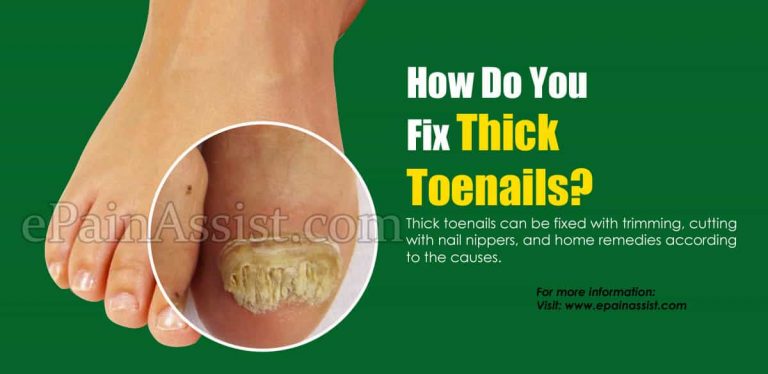 How Do You Fix Thick Toenails?