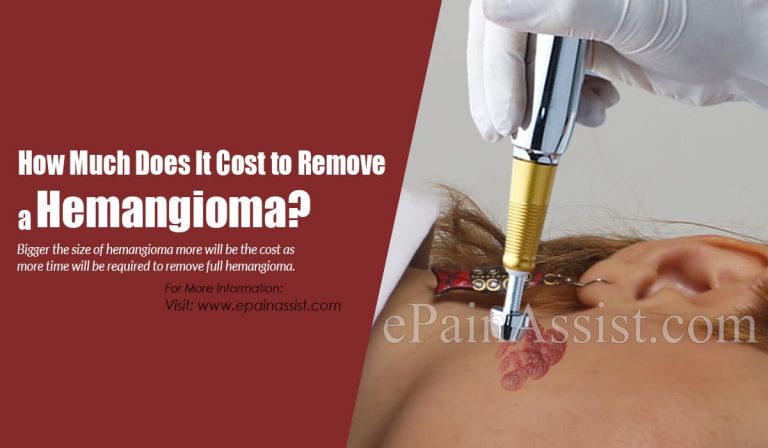 How Much Does It Cost To Remove A Hemangioma?