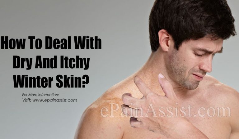 How to Deal With Dry and Itchy Winter Skin?