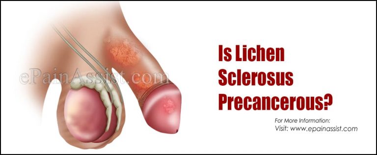 Is Lichen Sclerosus Precancerous?