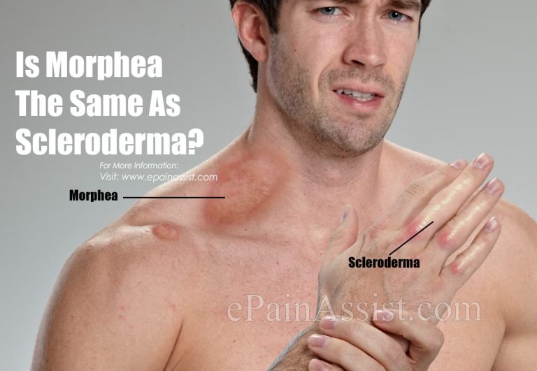 Is Morphea The Same As Scleroderma?