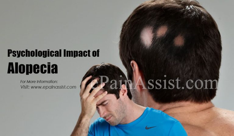 Psychological Impact of Alopecia & Its Treatment