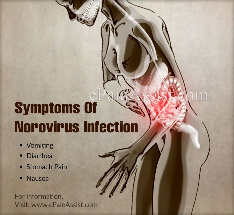 How Dangerous Is Norovirus Infection & Is It Contagious?