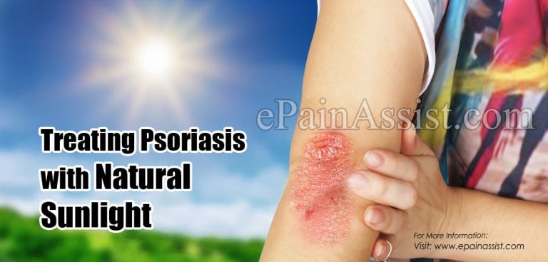 Treating Psoriasis with Natural Sunlight & Phototherapy