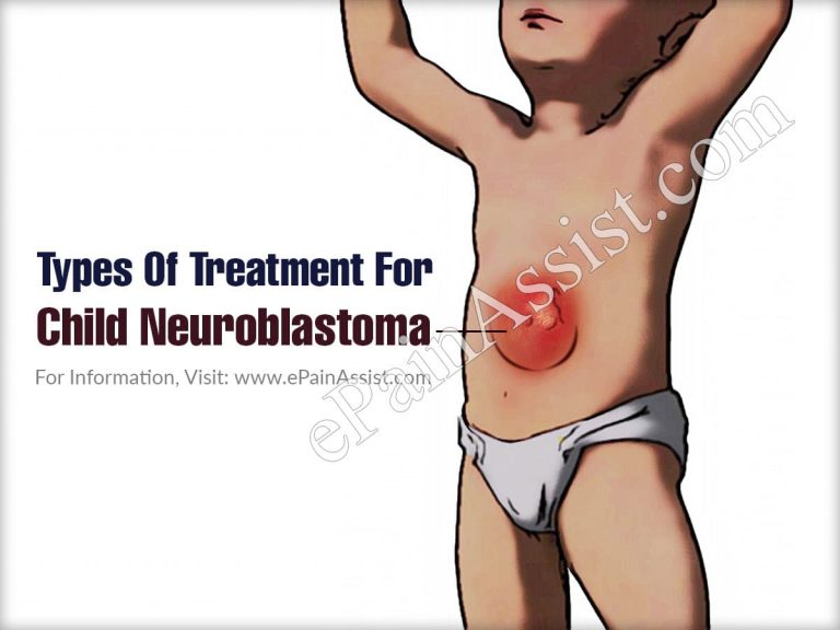 Home Remedies For Neuroblastoma