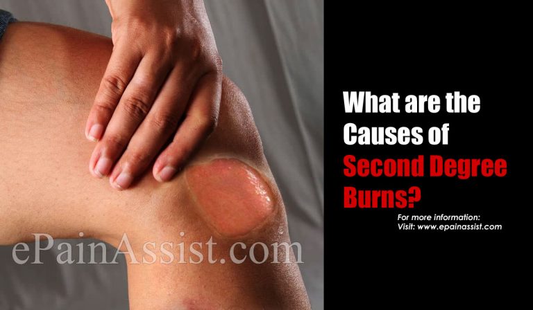Ways to Protect & Cool Second Degree Burns & Its Treatment, Recovery