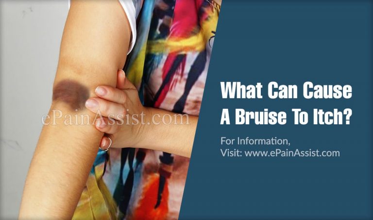 What Can Cause A Bruise To Itch & How is Itchy Bruise Treated?