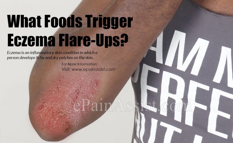 What Foods Trigger Eczema Flare-Ups?