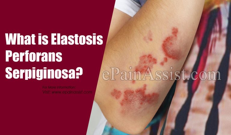 What is Elastosis Perforans Serpiginosa & How is it Treated?|Risk, Causes, Symptoms of Elastosis Perforans Serpiginosa
