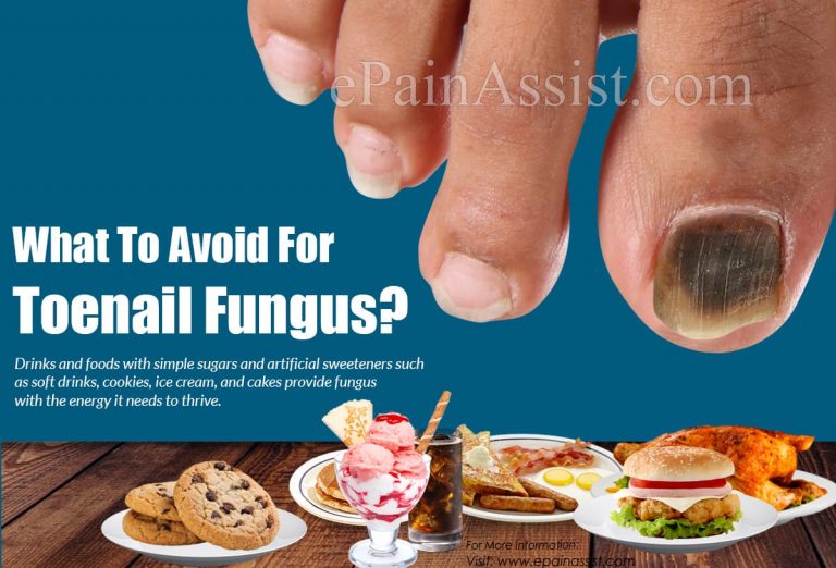 What To Eat & Avoid For Toenail Fungus?