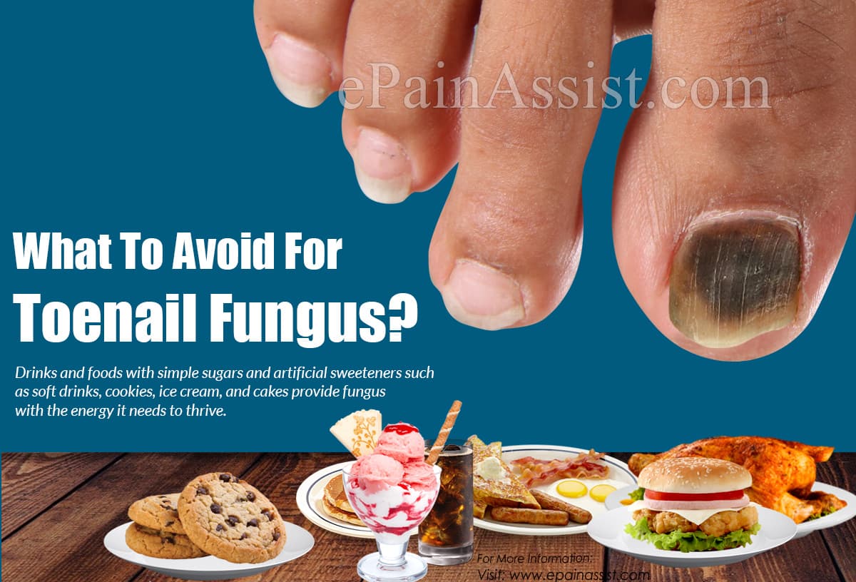 What To Avoid For Toenail Fungus?