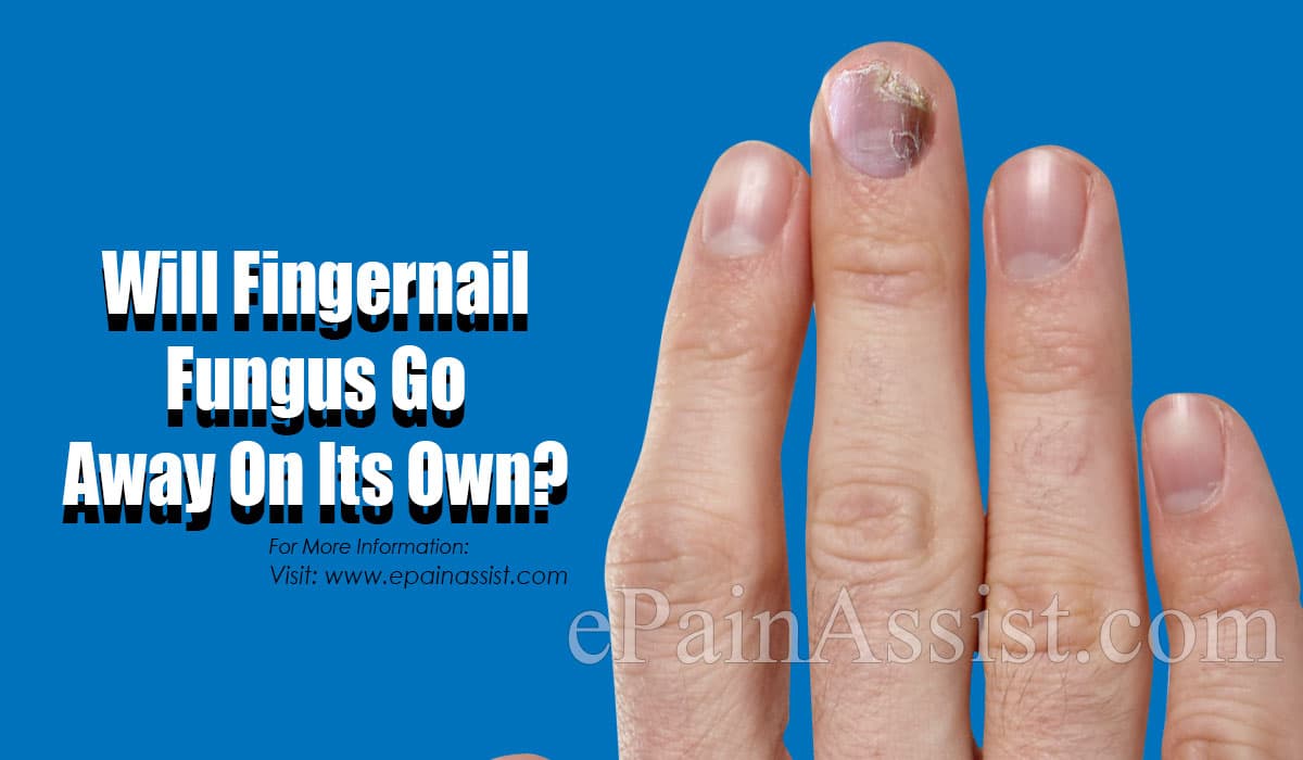 Will Fingernail Fungus Go Away On Its Own If Not Then What Is Its Treatment