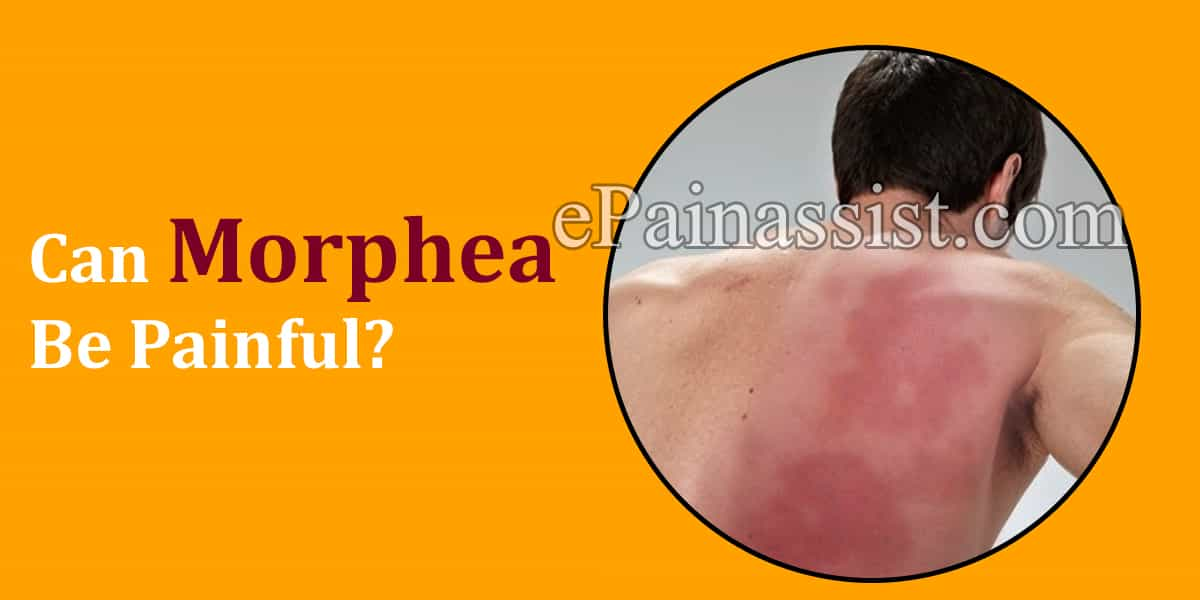 Can Morphea Be Painful?