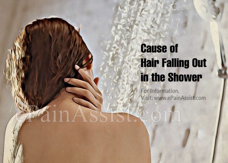 Causes of Hair Falling Out in the Shower & Its Treatment