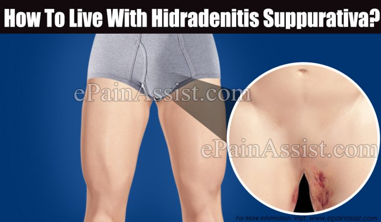 How To Live With Hidradenitis Suppurativa?