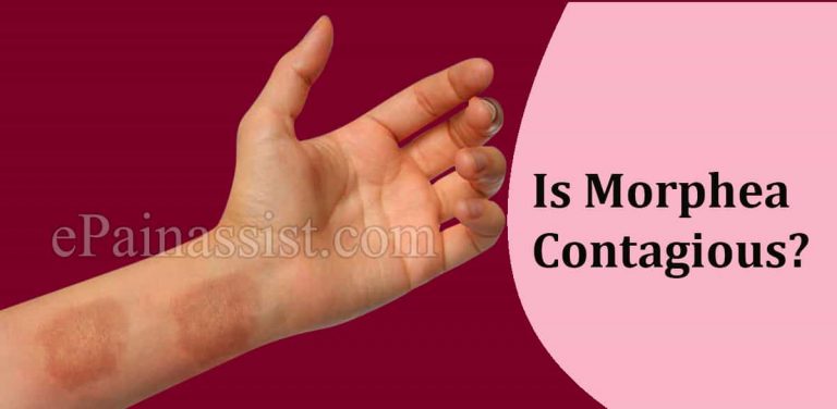 Is Morphea Contagious?