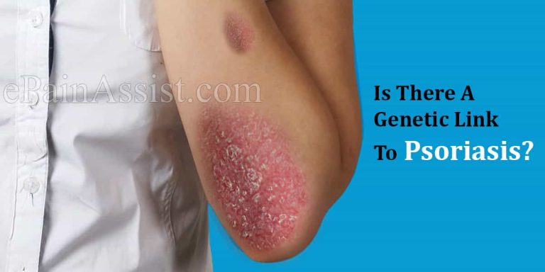 Is There A Genetic Link To Psoriasis?