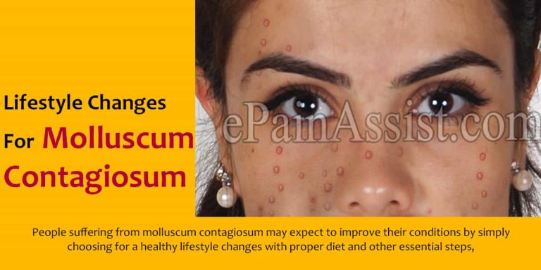 Lifestyle Changes For Molluscum Contagiosum