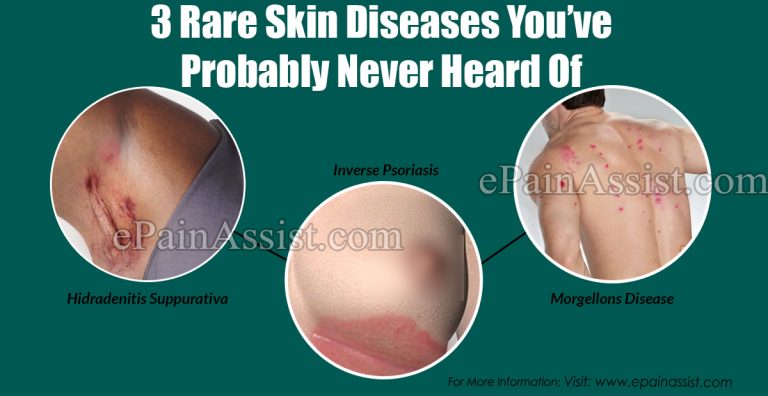 3 Rare Skin Diseases You’ve Probably Never Heard Of