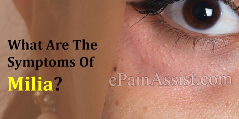 What Are The Symptoms Of Milia?