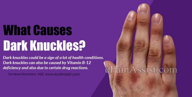 What Causes Dark Knuckles and How To Treat Them?