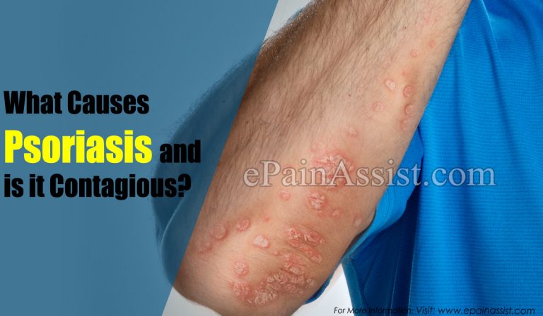 What Causes Psoriasis and is it Contagious?
