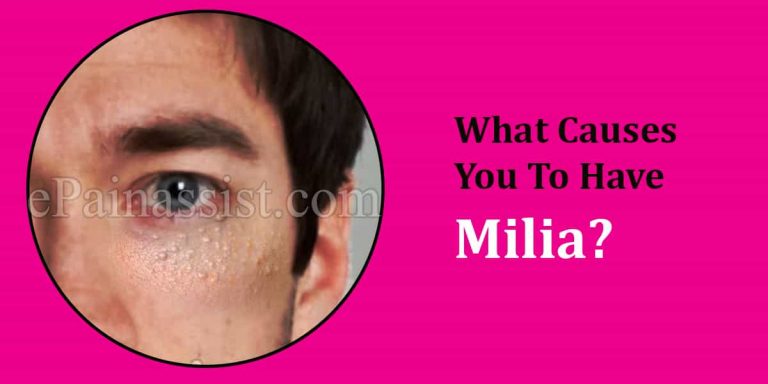What Causes You To Have Milia?