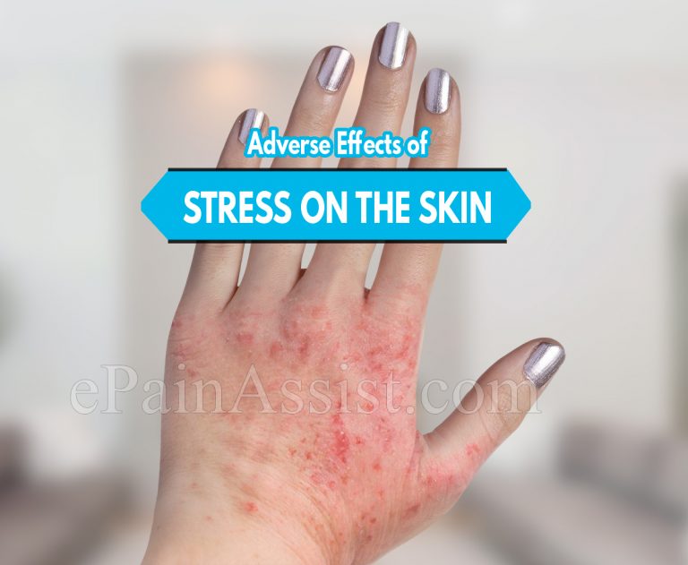 Adverse Effects of Stress on the Skin