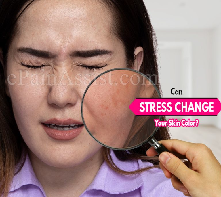 Can Stress Change Your Skin Color?