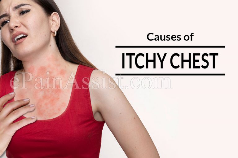 Causes of Itchy Chest & its Treatment
