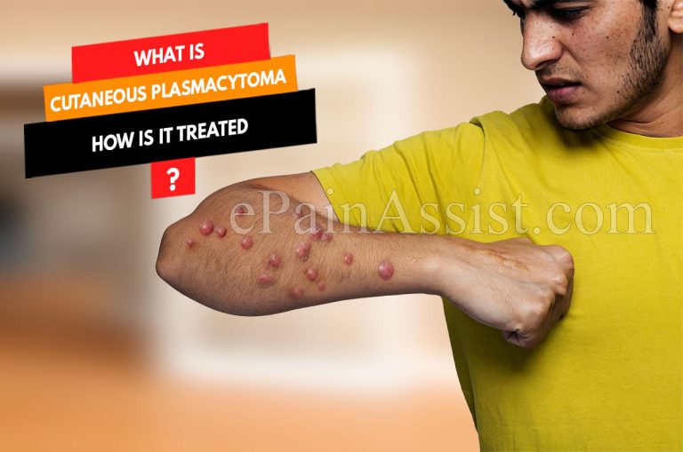 What is Cutaneous Plasmacytoma & How is it Treated? | Causes, Symptoms and Diagnosis of Cutaneous Plasmacytoma