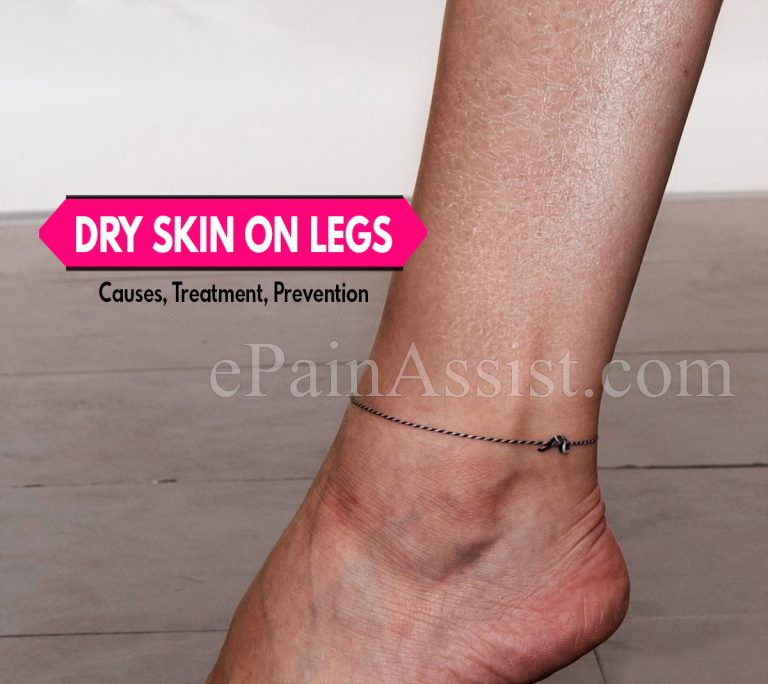 Dry Skin On Legs: Causes, Treatment, Do’s & Don’ts, Prevention