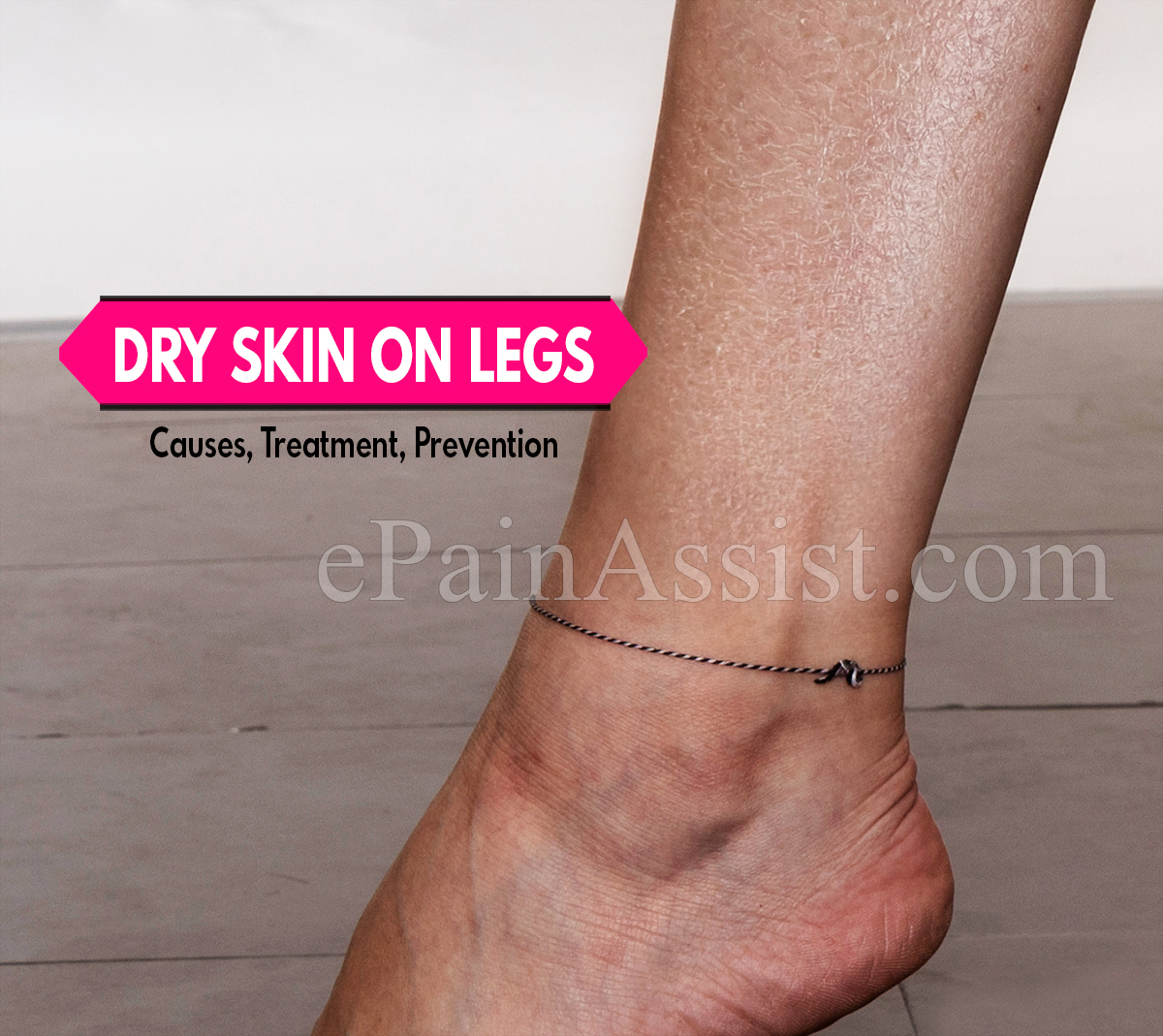 Dry Skin On Legs: Causes, Treatment