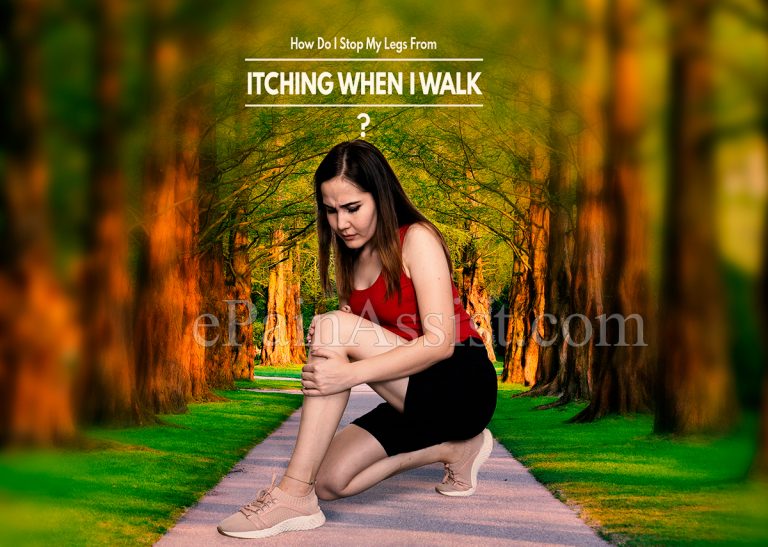 How Do I Stop My Legs From Itching When I Walk?