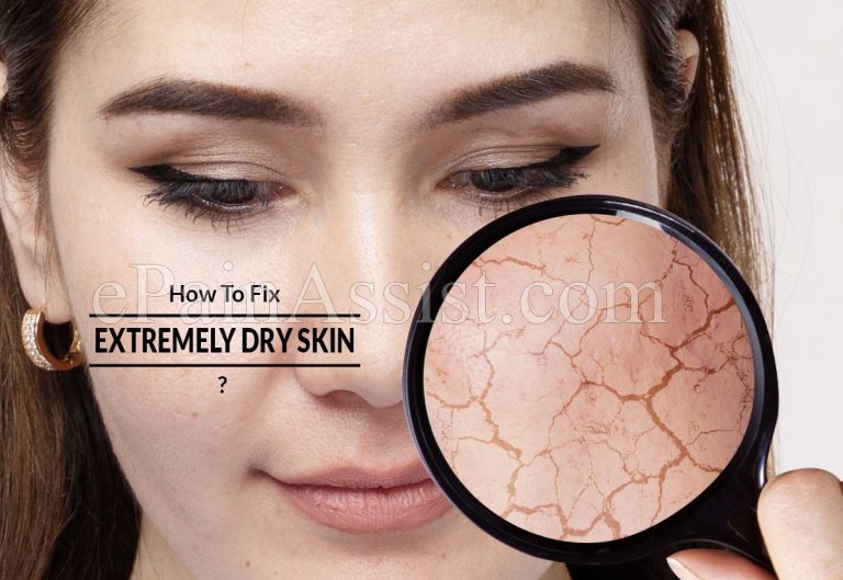 How To Fix An Extremely Dry Skin?