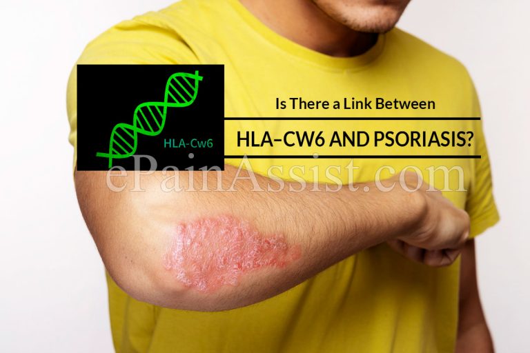 Is There a Link Between HLA–Cw6 and Psoriasis?