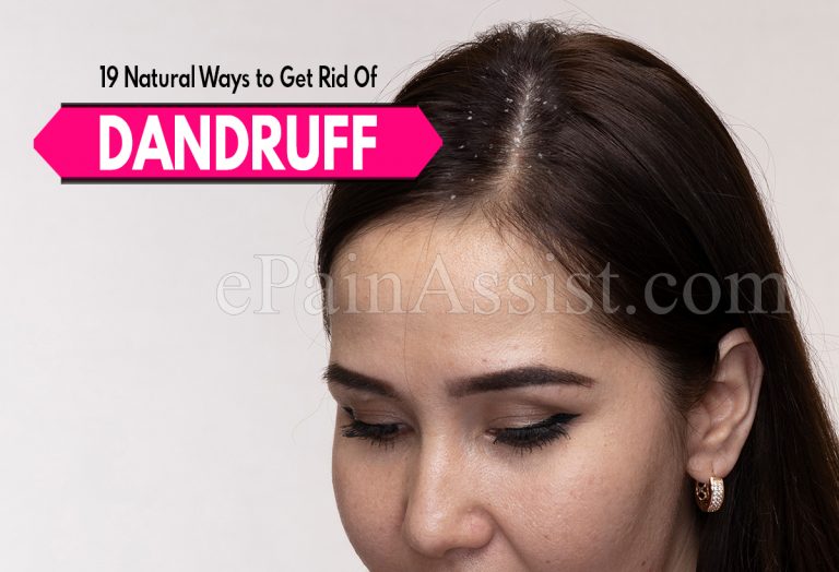 19 Natural Ways to Get Rid Of Dandruff