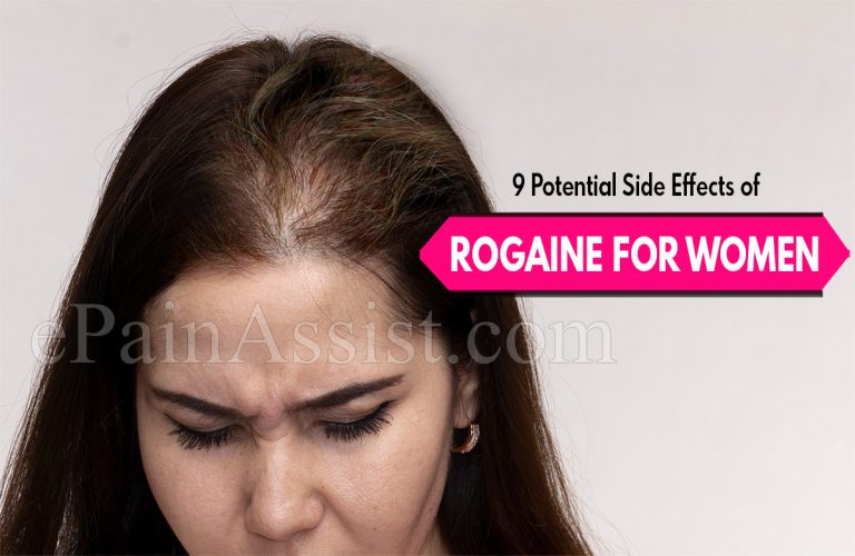 9 Potential Side Effects of Rogaine For Women