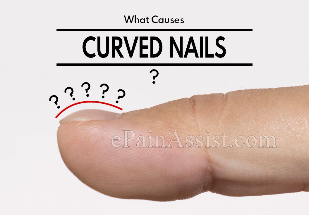 What Causes Curved Nails?