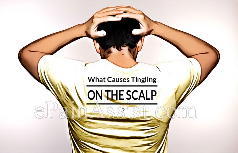 What Causes Tingling on the Scalp and How to Get Rid of It?