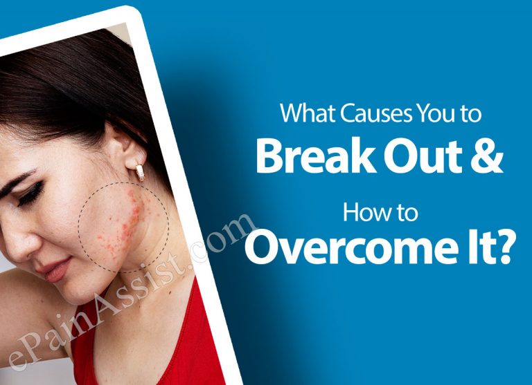 What Causes You to Break Out & How to Overcome It?