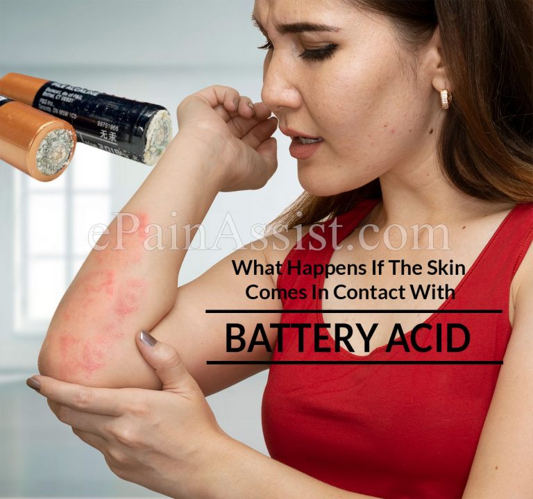 What Happens If The Skin Comes In Contact With Battery Acid & How To Treat It?