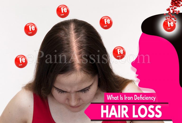 What Is Iron Deficiency Hair Loss and How To Deal With It?