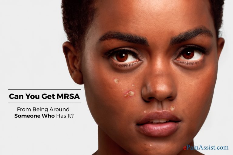 Can You Get MRSA From Being Around Someone Who Has It?