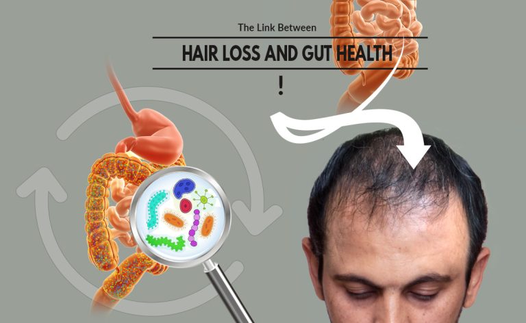 The Link Between Hair Loss and Gut Health